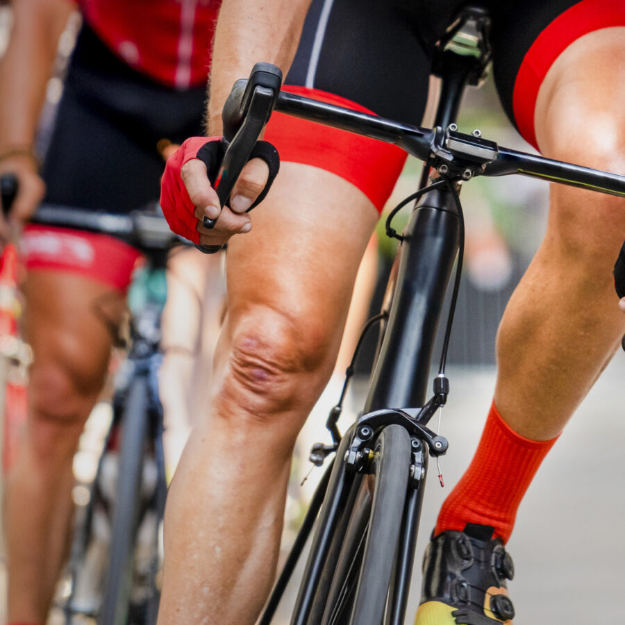 Körperregionen Patellaluxation - Radrennen